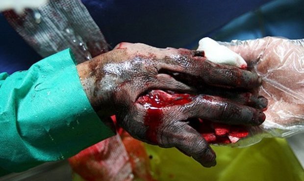 اخبار لحظه به لحظه| ۷ مصدوم در حوادث چهارشنبه اخر سال در آذربایجان‌شرقی