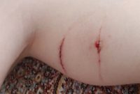 حمله سگ‌ هار به پسر ۱۲ ساله در مرکز شهر تبریز